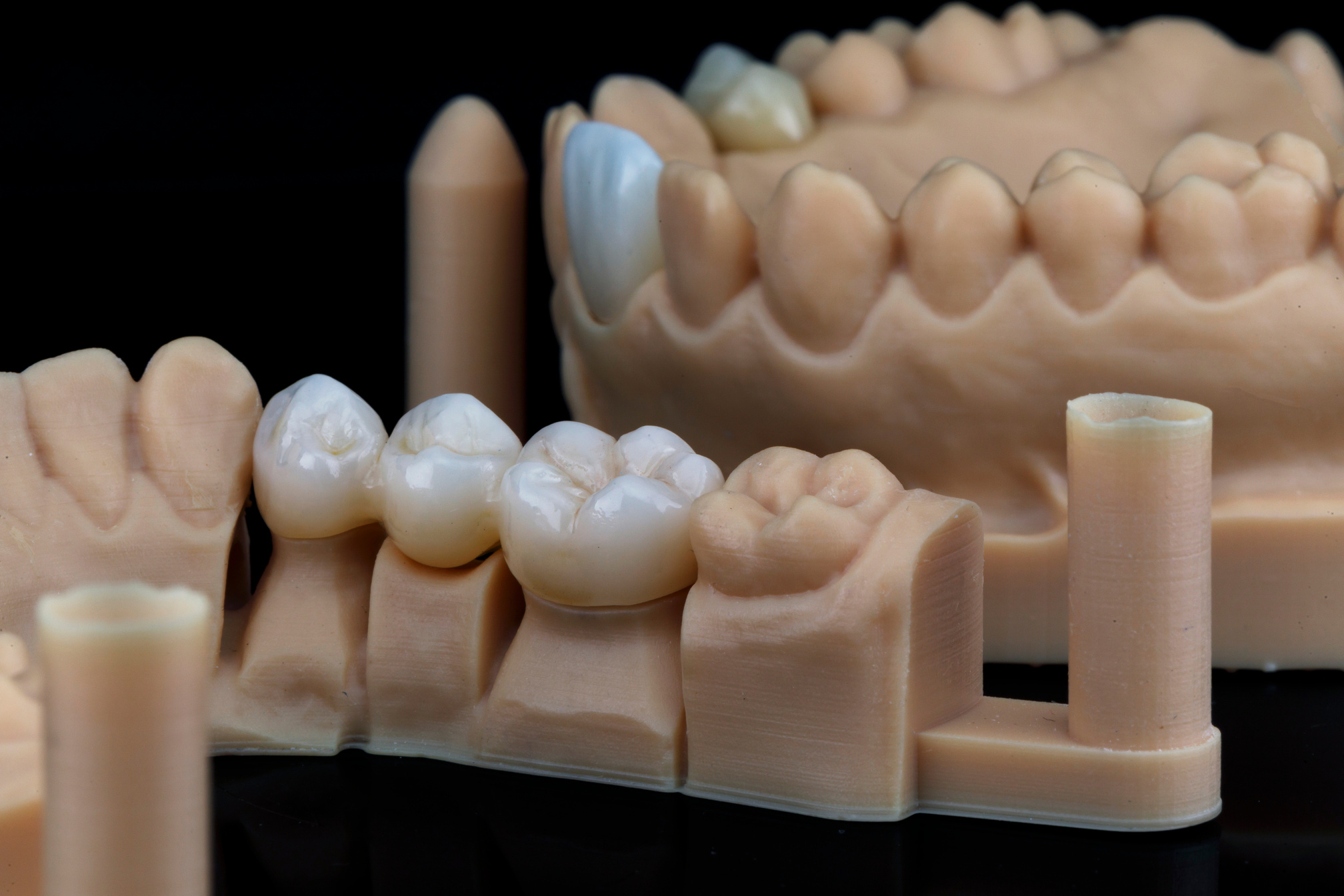 Milled Dental Crowns Made of Dental Zircon on Resin Models